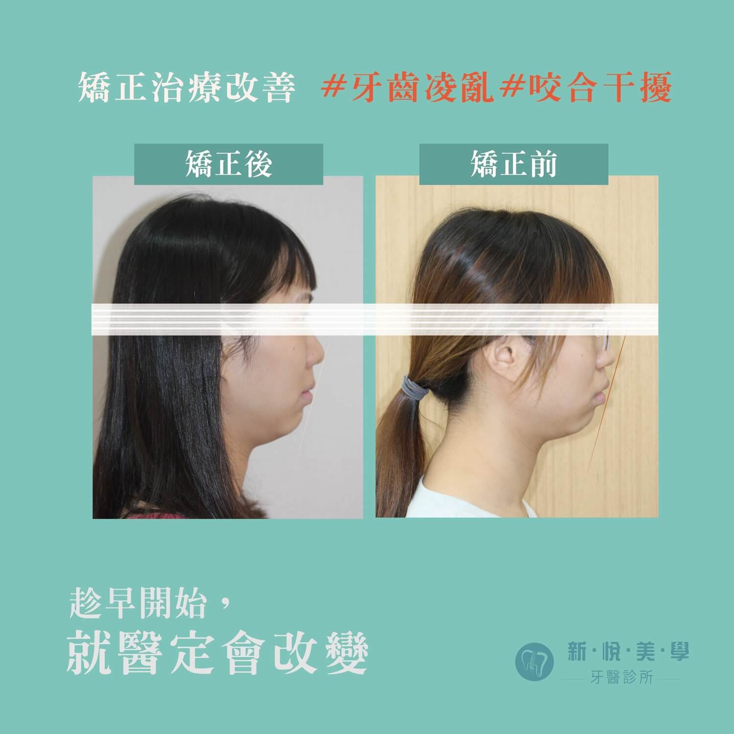 社會工作師”勇敢啟程”改變的決心，永遠不嫌晚！的第2張圖片